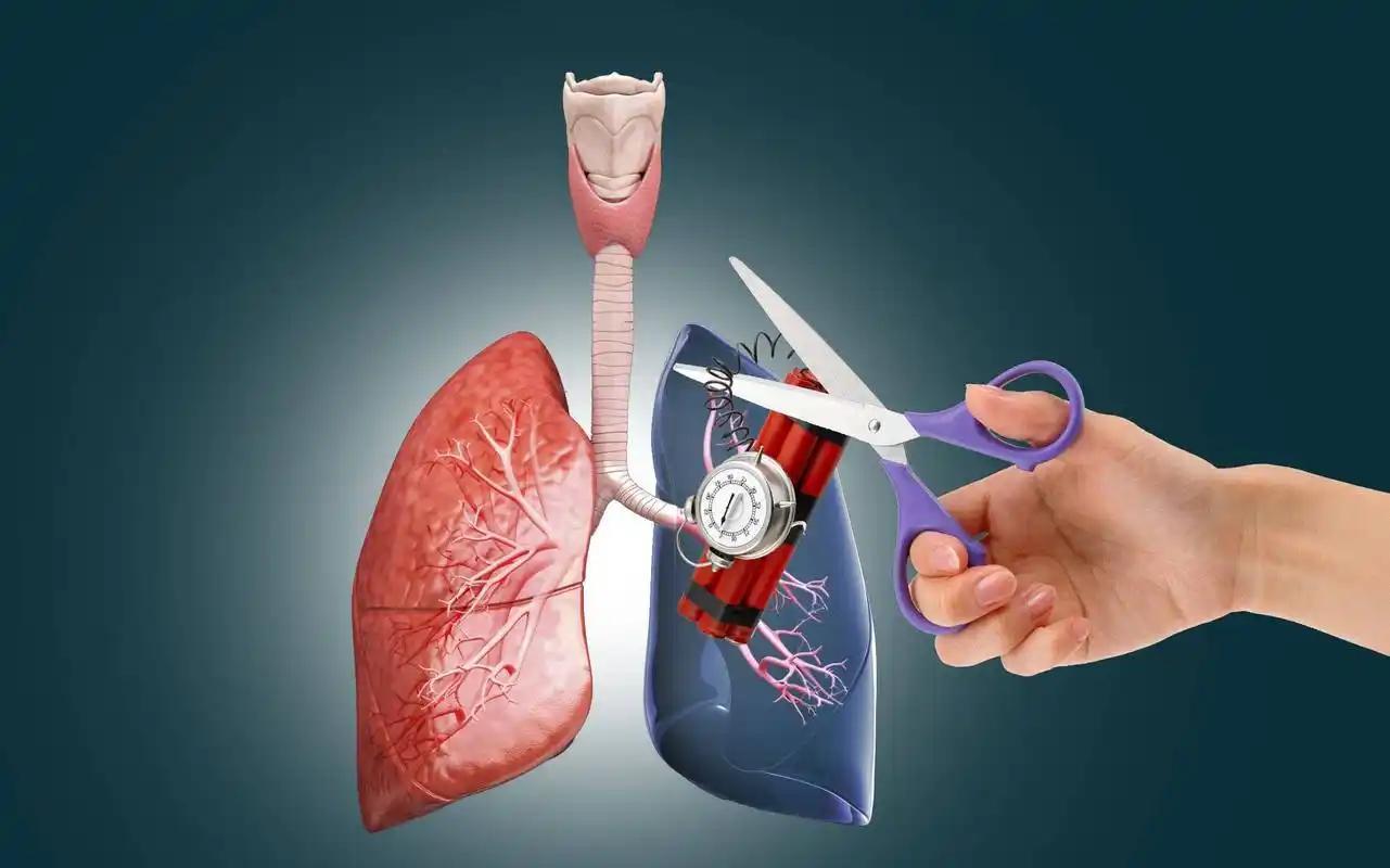 开云体育入口-女子因肺栓塞不幸走了！医生：天冷宁愿躺一天，也别干这5事！